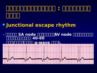 EKG interpretation 59_4 - อ.วินิตย์หลงละเลิง.pptx