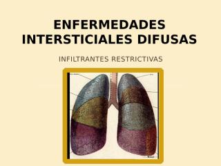 Equipo 2 - Enfermedades Intersticiales Difusas.pptx